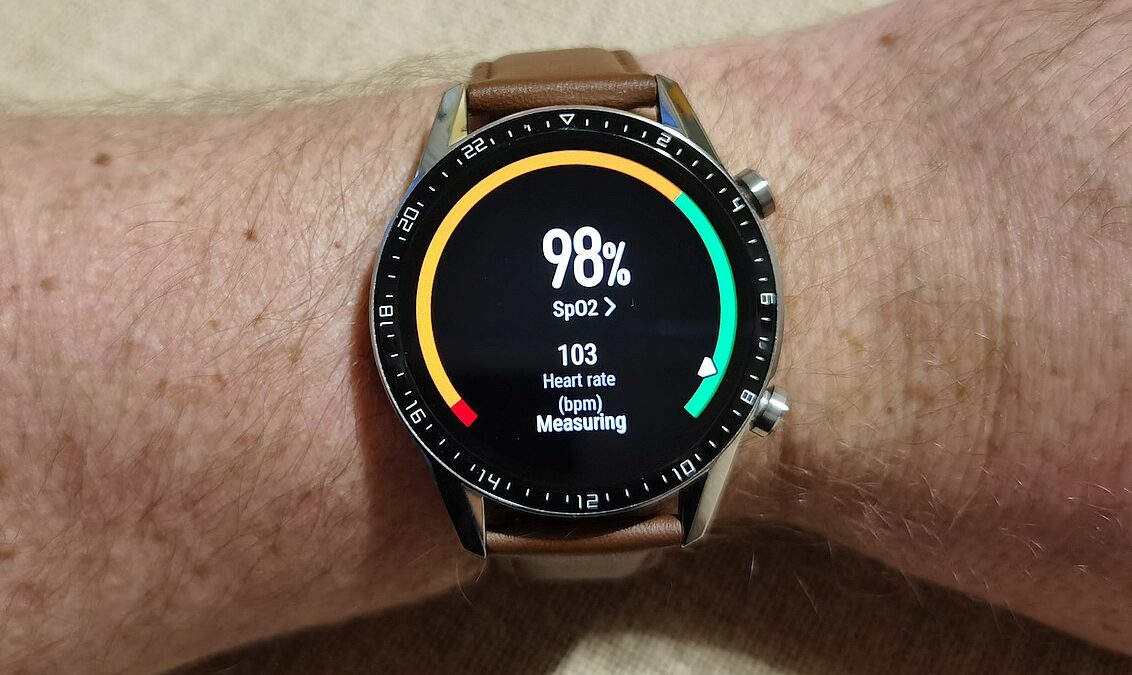 Wathc GT 2 OS2 update 8