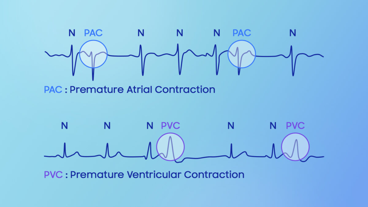 Samsung Galaxy Watch inovativni senzor1