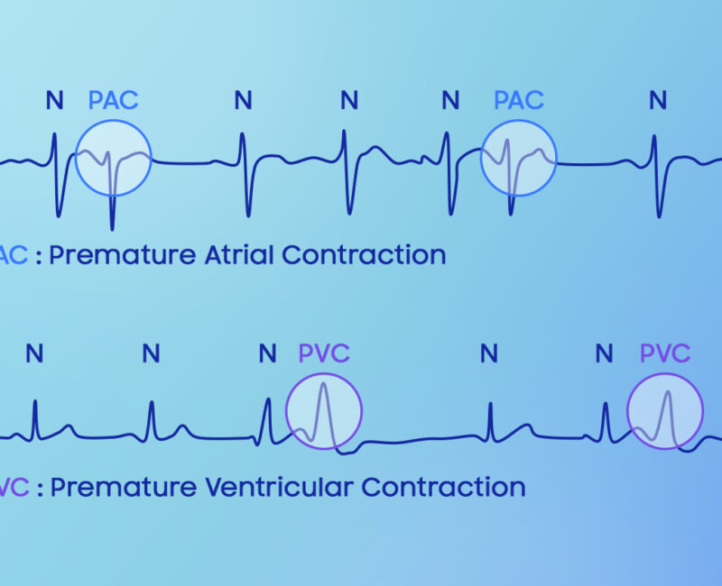 Samsung Galaxy Watch inovativni senzor1